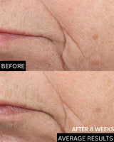 Advanced Barrier Repair Moisturiser